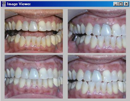 Dental Image Evaluation