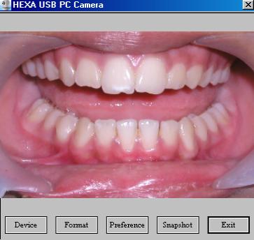 Dental Image Scanning